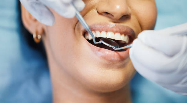 Best Emergency Tooth Extraction in Wood Village, OR