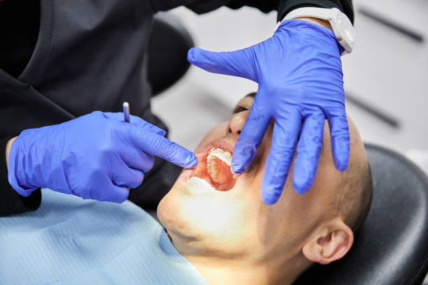 Best Emergency Wisdom Teeth Removal in Wood Village, OR